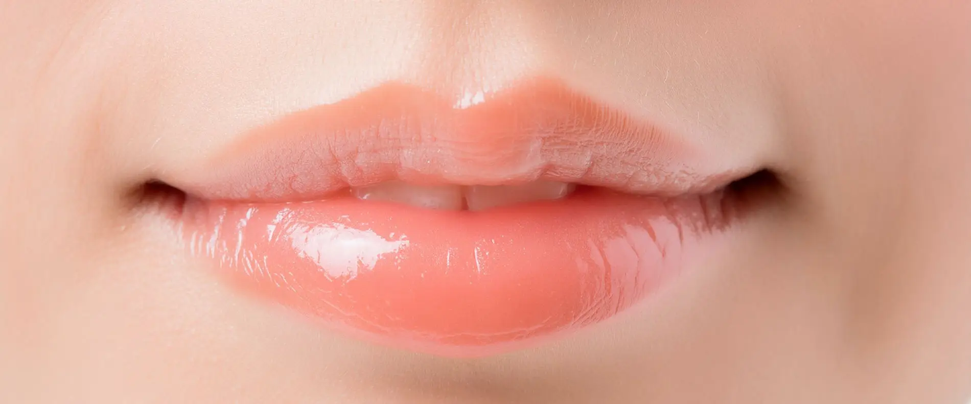 lippenunterspritzung